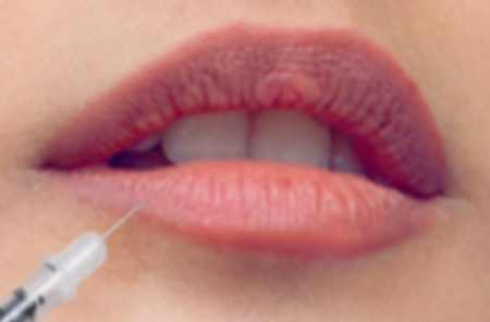DERMAL FILLER TREATMENT